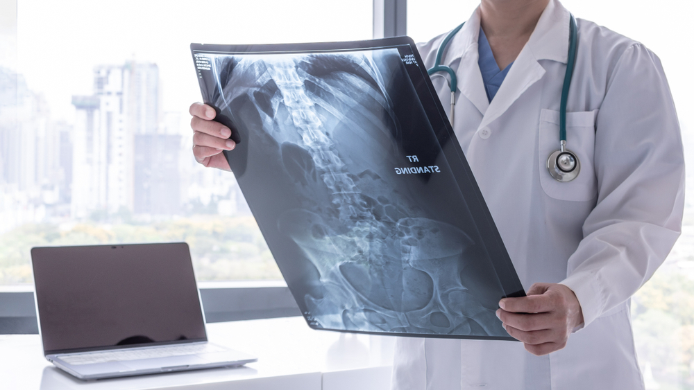 chron's disease swetech medical center