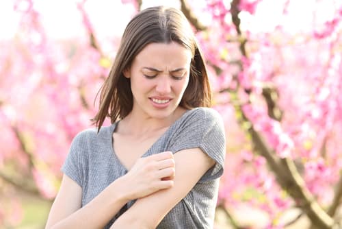 chronic condition eczema spring flare-up dr maria swetech